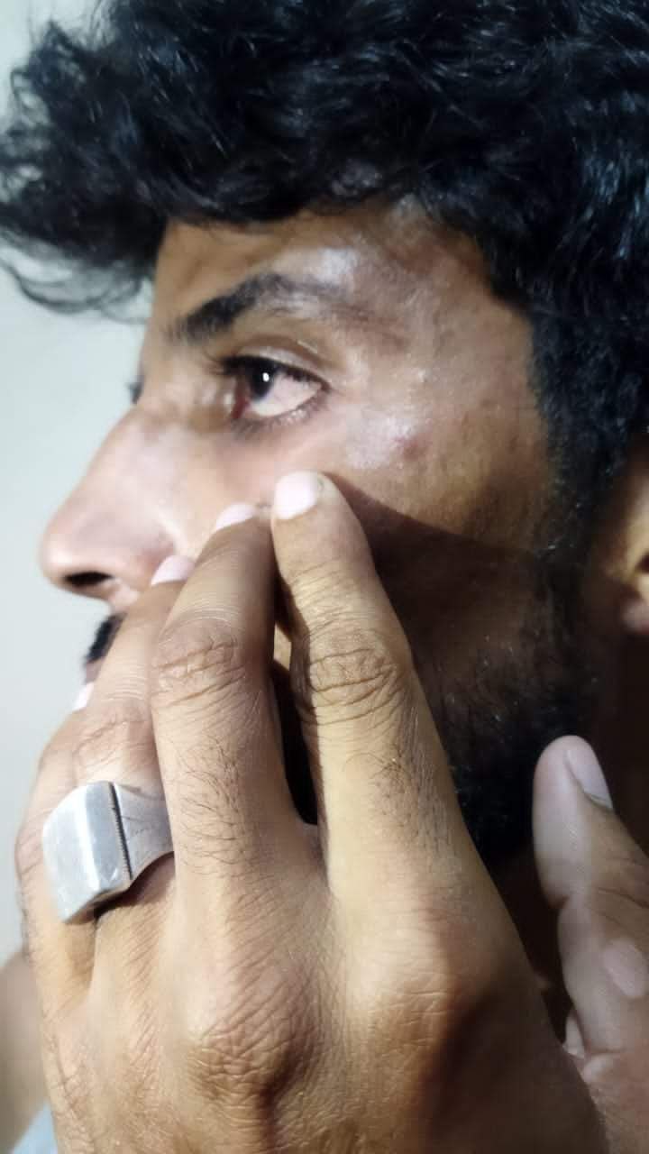 عاجل : الاعتداء بضرب على المواطنين الصحراويين لمشاركتهم في الوقفة السلمية